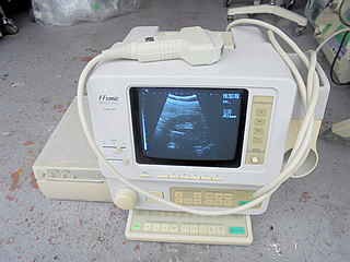 ポータブル超音波診断装置（腹部用）