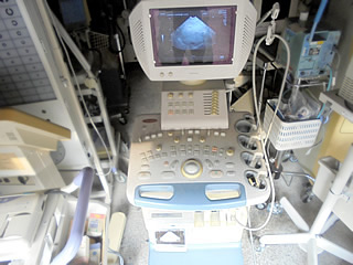 超音波診断装置（マイクロコンベックスプローブ付）